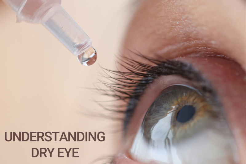 Understanding Dry Eye